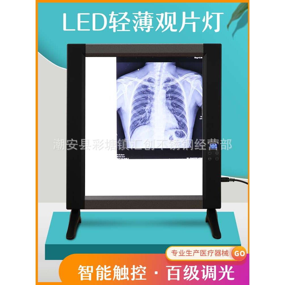 智能液晶调光观片灯led超薄触控看阅片骨科胶片x光插片即亮单联款