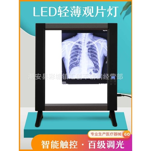 智能液晶调光观片灯led超薄触控看阅片骨科胶片x光插片即亮单联款