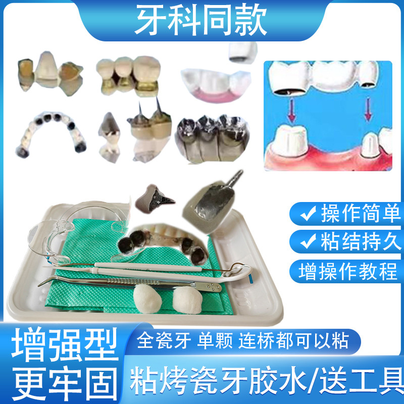 全粘烤瓷牙假牙胶水牙冠粘接剂金属牙套连桥自己瓷牙粘合剂专用