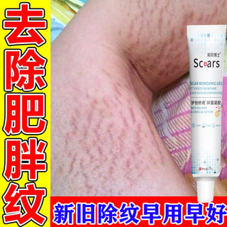 妊辰纹修复霜去肥胖纹学生大腿生长纹屁股孕妇精油女产后肚皮松垮