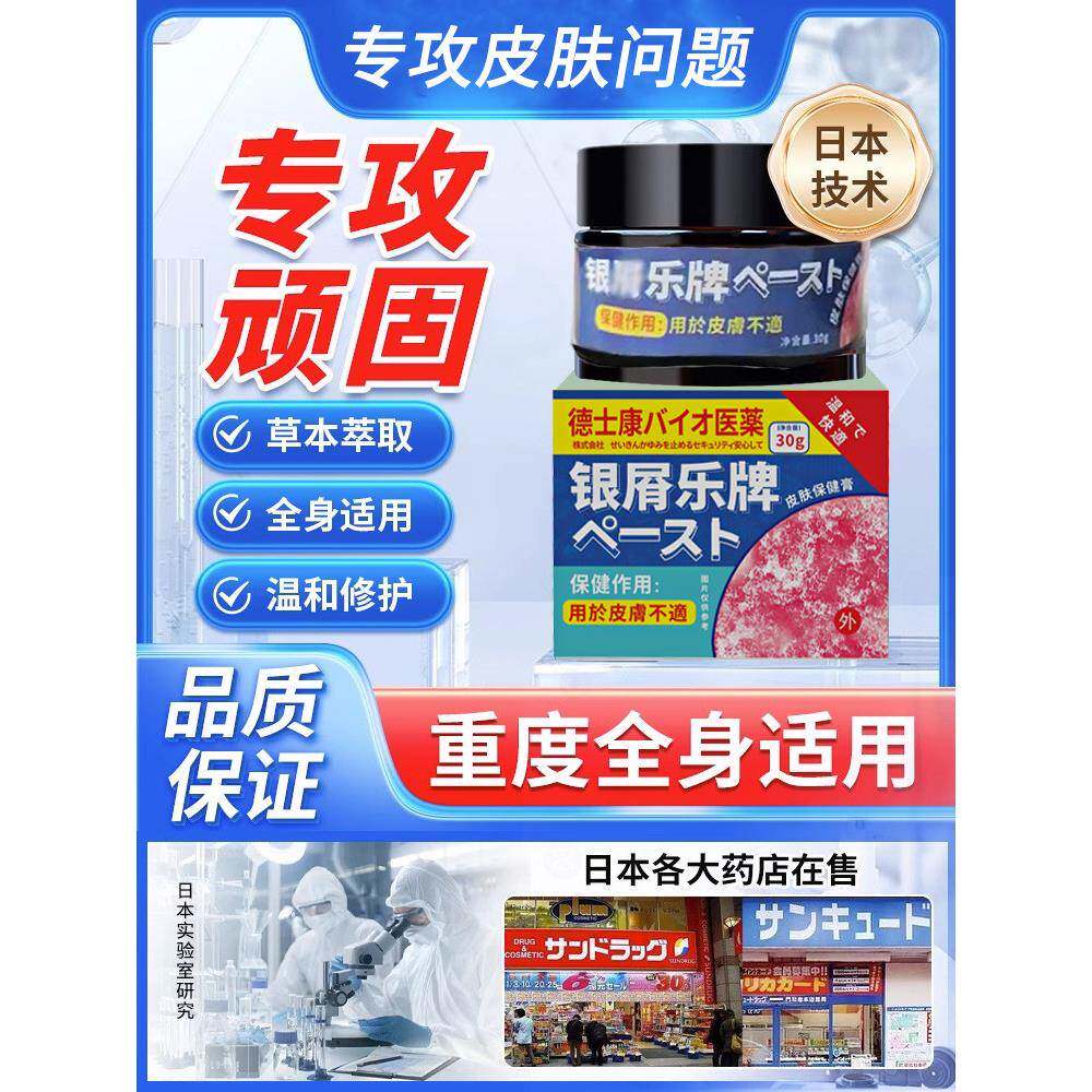 牛皮药膏藓头皮股银去屑病皮肤杀菌藓特效湿过敏疹止痒正品专用