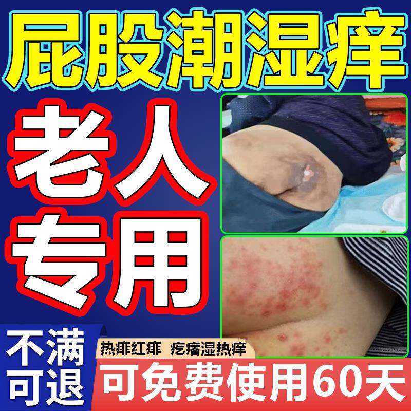 卧床老人爽身粉褥疮长期卧床热痱红痱瘙痒疙瘩潮湿屁股私处溃烂粉