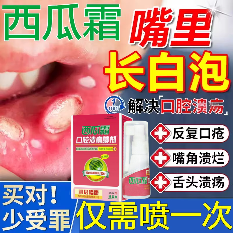 西瓜霜口腔生疮喷雾剂口腔溃疡儿童型成人三桂金林官方旗舰店正品