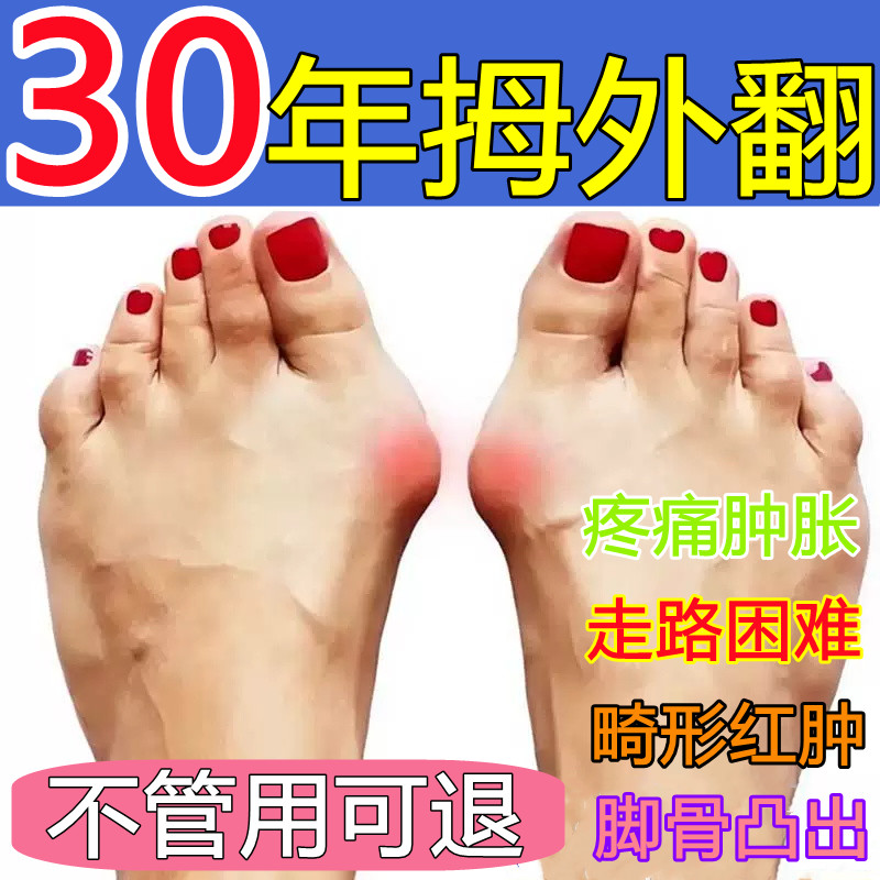 拇指外翻膏药贴大拇指疼痛大脚骨母脚趾关节畸形矫正拇囊炎专用贴