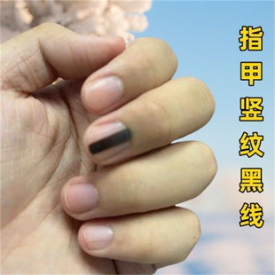 指甲黑色竖纹黑线指甲里面有黑线手指甲凹凸不平修复通用保湿修护