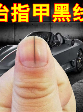 甲母痣指甲黑色竖纹黑线手指甲真菌感染指甲有黑线手指甲护理专用