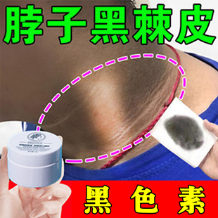 脖子黑脖子黑色素沉淀黑棘皮洗不干净黑儿童小孩成人脖子黑