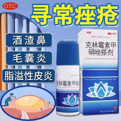 包邮天龙鑫烨太布克林霉素甲硝唑搽剂20ml痤疮药脂溢性皮炎毛囊炎