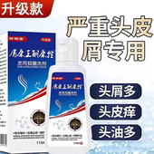 屑康王酮康唑洗剂110ml头皮糠疹头皮屑局部性花斑癣脂溢性皮炎