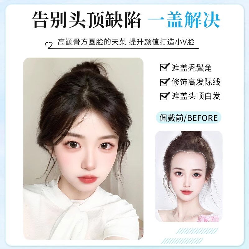 假发女片a头顶补发增发量蓬松高颅顶全真发前额自然隐形假刘海