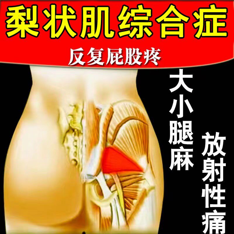 髋关节股骨头疼痛贴大腿屁股疼梨状肌关节尾椎疼塌积液坏陷中药贴