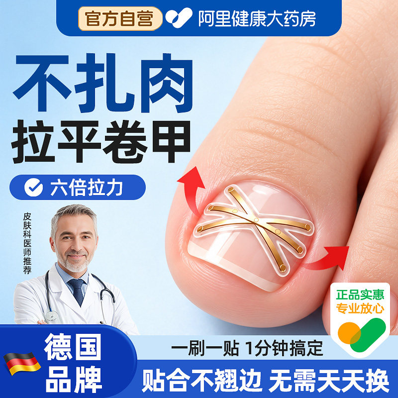 甲沟嵌甲矫正器正甲贴片成人儿童脚趾炎指甲往肉里长专用纠正神器