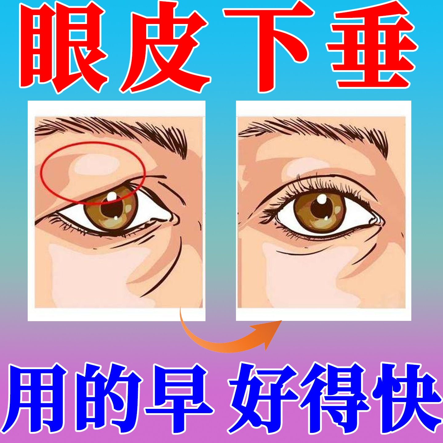眼皮下垂提拉眼贴神器中