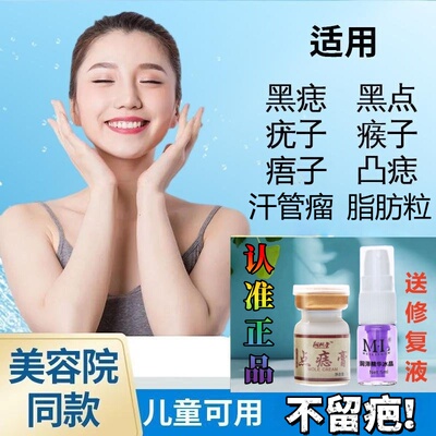 美容院同款官方正品点痣膏去志