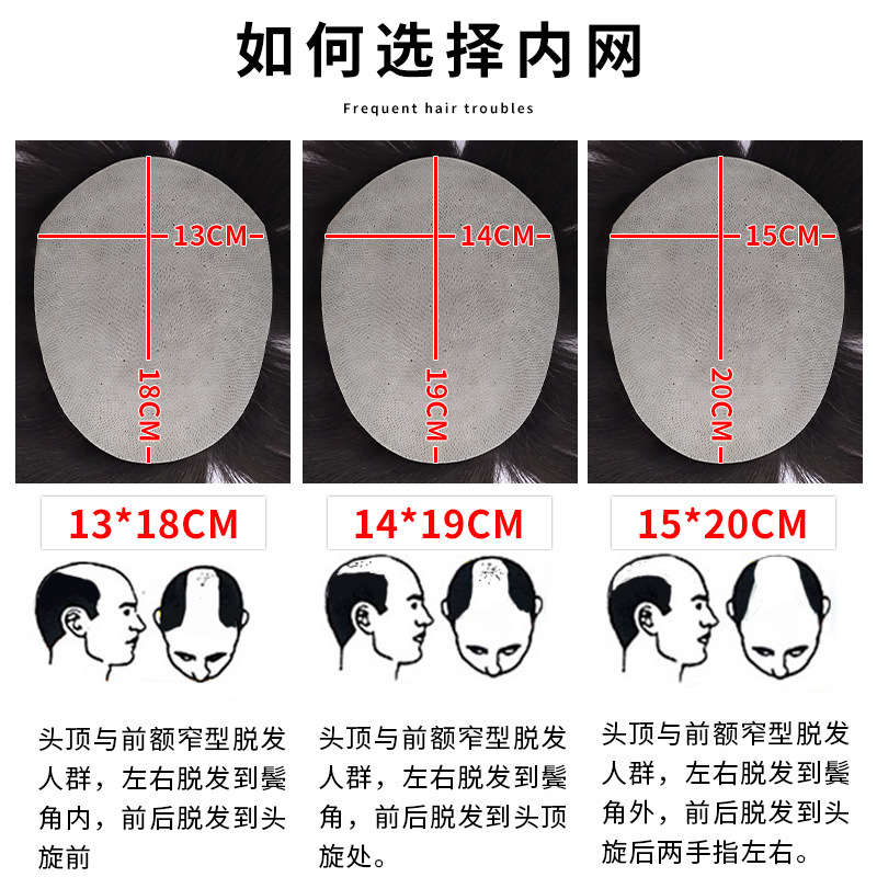 高端补发遮白发秃发假发男补发片真人发头顶补发块假发片男士假发