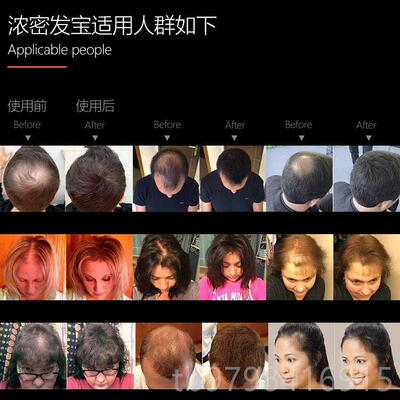 正品dexe头发密发发纤维粉增发秃补发神器顶少稀发变多假美发粉头