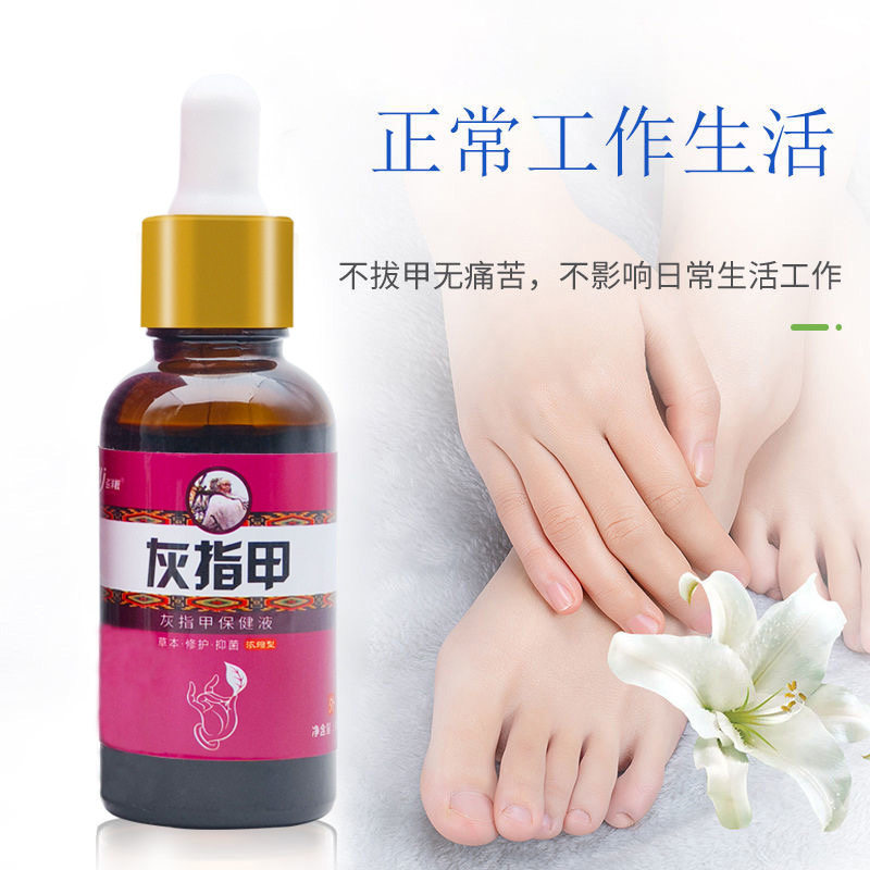 厂家供应巡洋舰灰指趾甲护理油剂30ml灰指趾甲液去足部灰指甲液图片