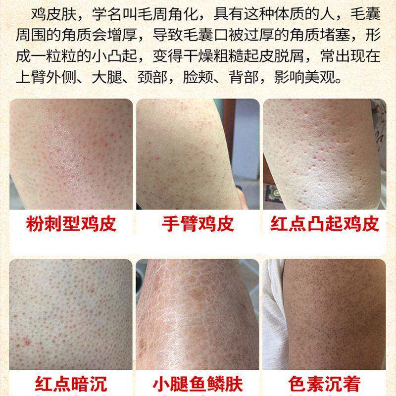 身体磨砂膏美嫩白去角质烟酰胺全身去鸡皮留香身体手腿部磨砂膏