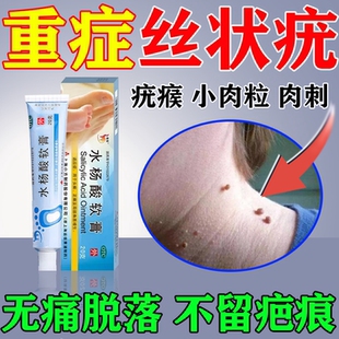 水杨酸软膏正品官方去疣瘊小肉粒丝状疣扁平疣专用药【视觉特效】