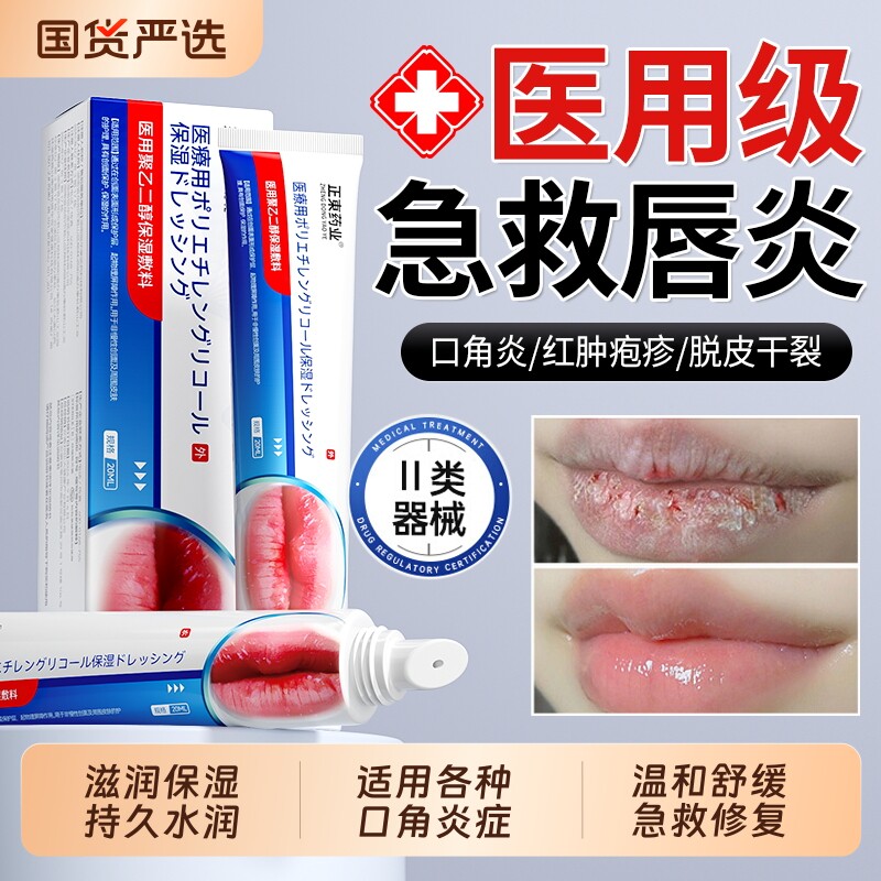 唇炎唇膏润唇膏嘴唇干裂脱皮医用去死皮女保湿滋润专用口角炎疱疹
