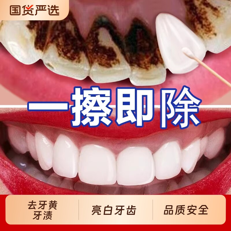 牙斑净牙齿非美白速效去烟渍擦黄牙洗污垢牙菌斑祛除神器云南本草