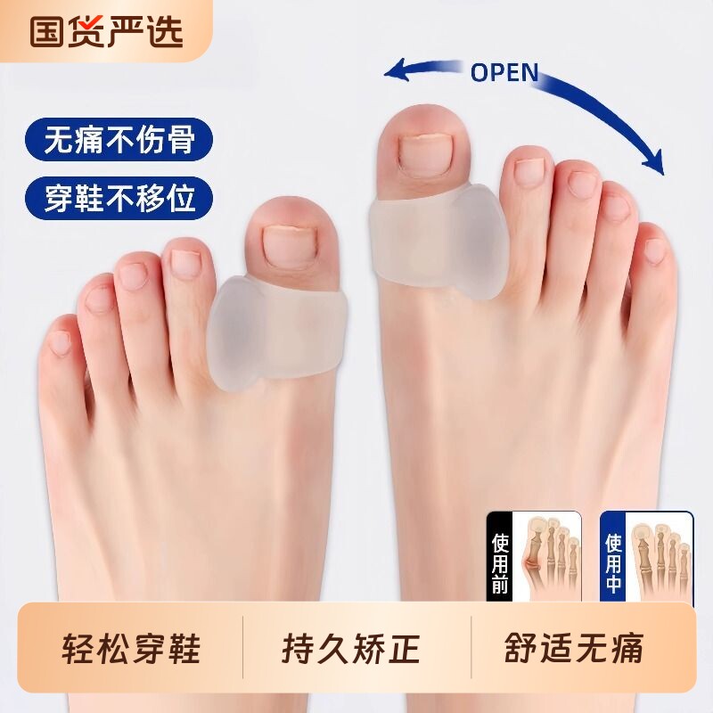 拇指外翻矫正器脚趾矫正器分趾器大脚骨突出分离器男女士通用