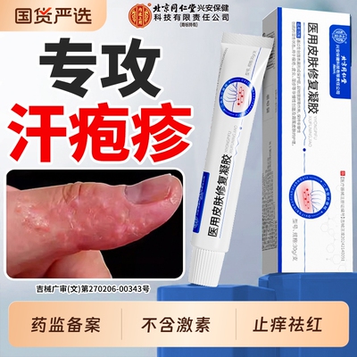 【汗疱疹专用】热销No.I