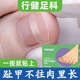 行健足科拉拉贴??脚指甲甲沟嵌甲矫正器炎趾甲长肉里纠正甲贴片