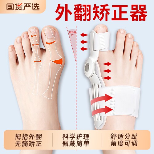 【无痛矫正】拇指外翻脚趾矫正器