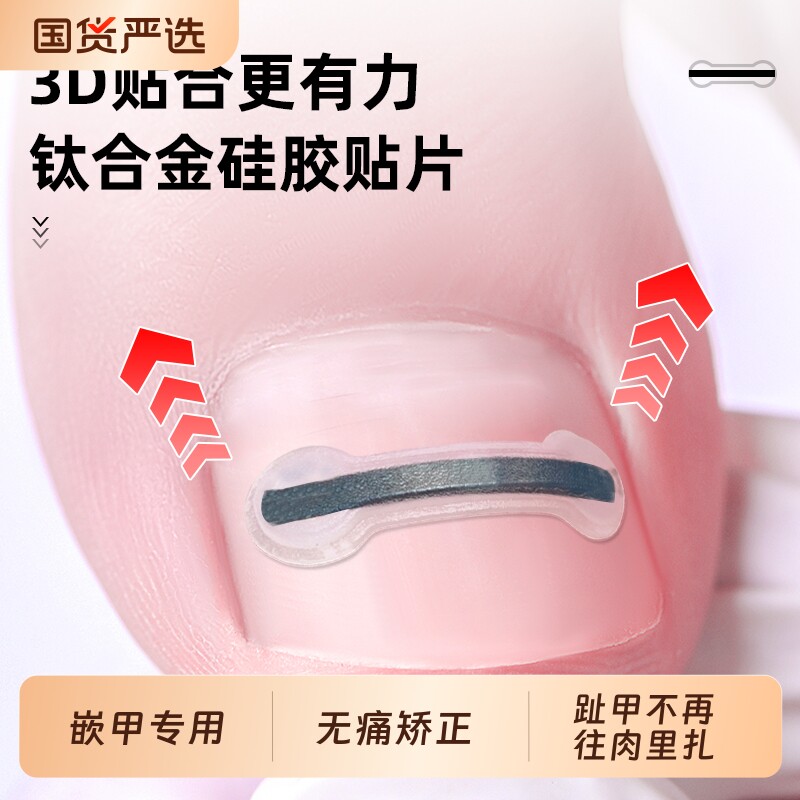脚医生甲沟嵌甲矫正器炎正甲贴片脚趾指甲往肉里长专用指甲刀套装