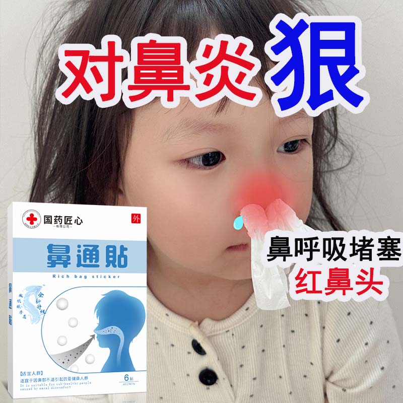 通气鼻贴儿童成人流鼻涕过敏性鼻塞通鼻贴神器草本舒鼻通气贴