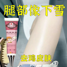 【官方正品】鸡皮肤疙瘩毛囊角化角质鱼鳞蛇霜干燥起皮去除神器