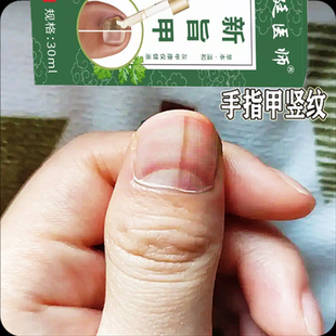 指甲盖中间竖纹裂开指甲有竖纹指甲表面凸起凹凸不平指甲防裂修复