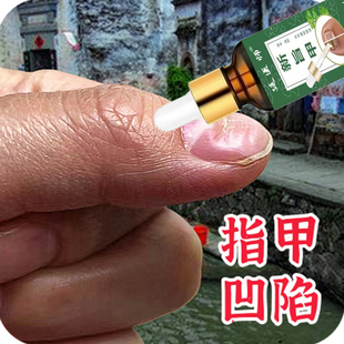 手指甲凹凸不平指甲凹凸不平修复凹坑小坑手指甲变形凹凸不平修复