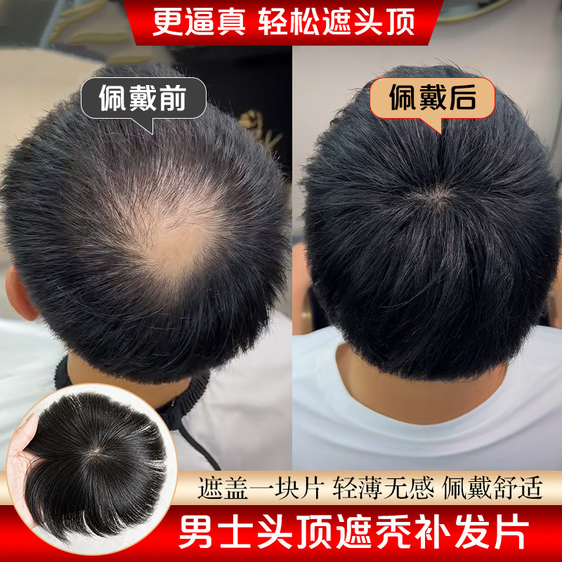 假发片男全真人发头旋发缝稀少脱发男士补发遮盖伤疤头顶部补发片