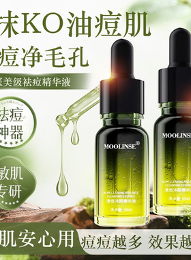 小绿瓶祛痘精华液淡化痘印改善干燥补水保湿水油平衡温和官方正品