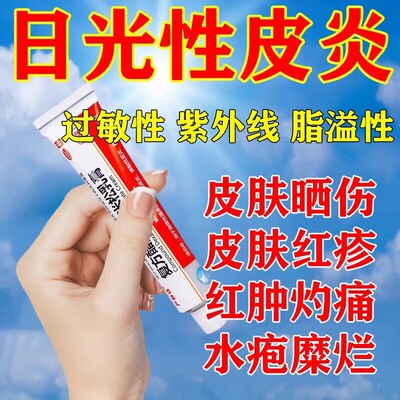 日光性皮炎紫外线过敏皮肤晒伤修复皮肤瘙痒起水泡止痒抑菌专用药