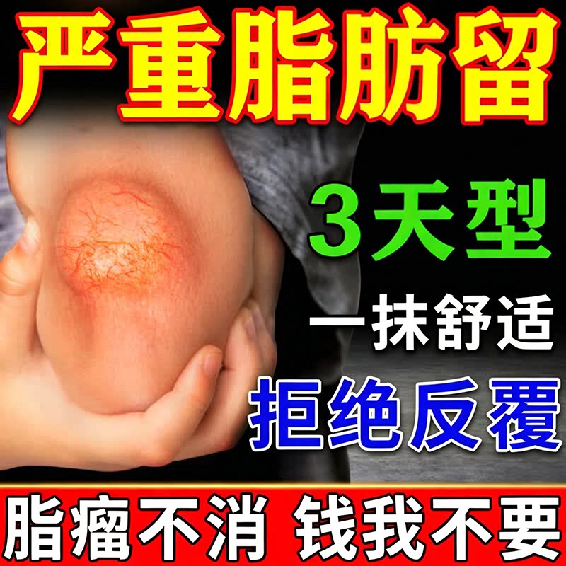 日本脂肪康消留膏药专用皮下治疗脂肪留肿硬块鼓包去除神器效特