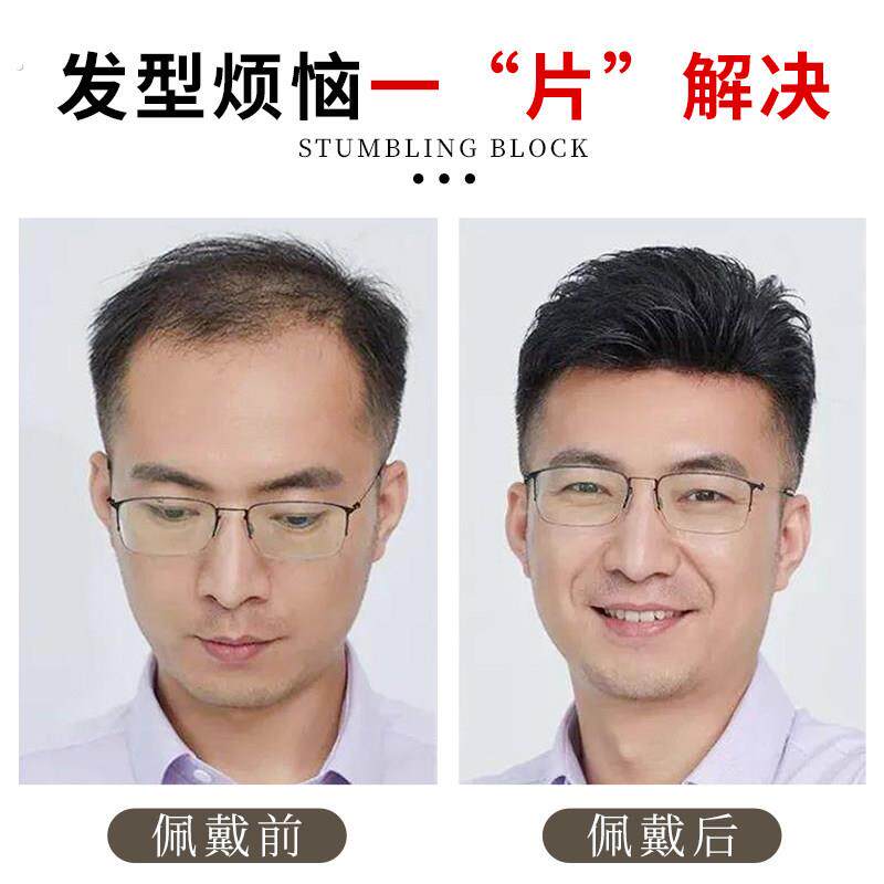 发际线假发贴男前额秃顶补发隐形无痕假发片精剪真发假刘海发片男