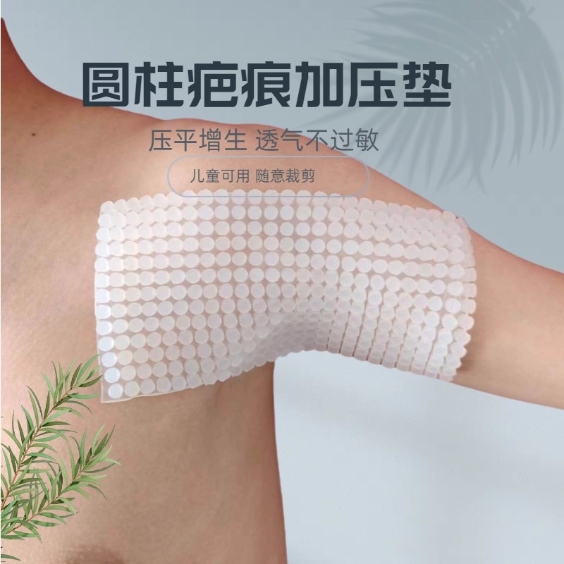 圆柱疤痕加压垫术后疙瘩增生疤痕贴硅凝胶弹力儿童烧烫伤增压