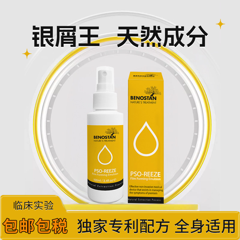 欧洲进口银屑病牛皮廯专用喷雾全身可用喷剂湿疹止痒皮肤专用药膏