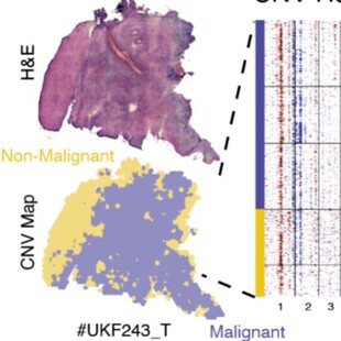 空间转录组分析空转分析spatial10xgenomics空转联合单细胞ST分析