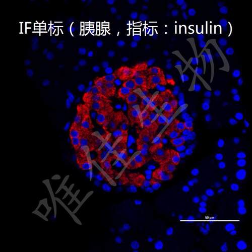 免疫组化(IHC)免疫荧光(IF) Tunel 凋亡 细胞实验图片量化分析