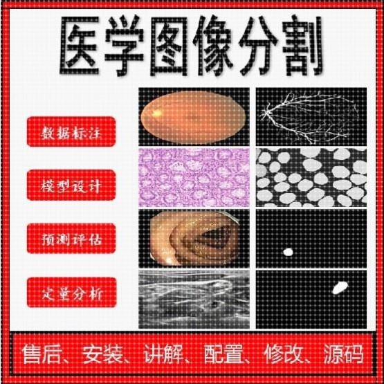 医学图像分割图像分割深度学习人工智能数据脱敏数据保密