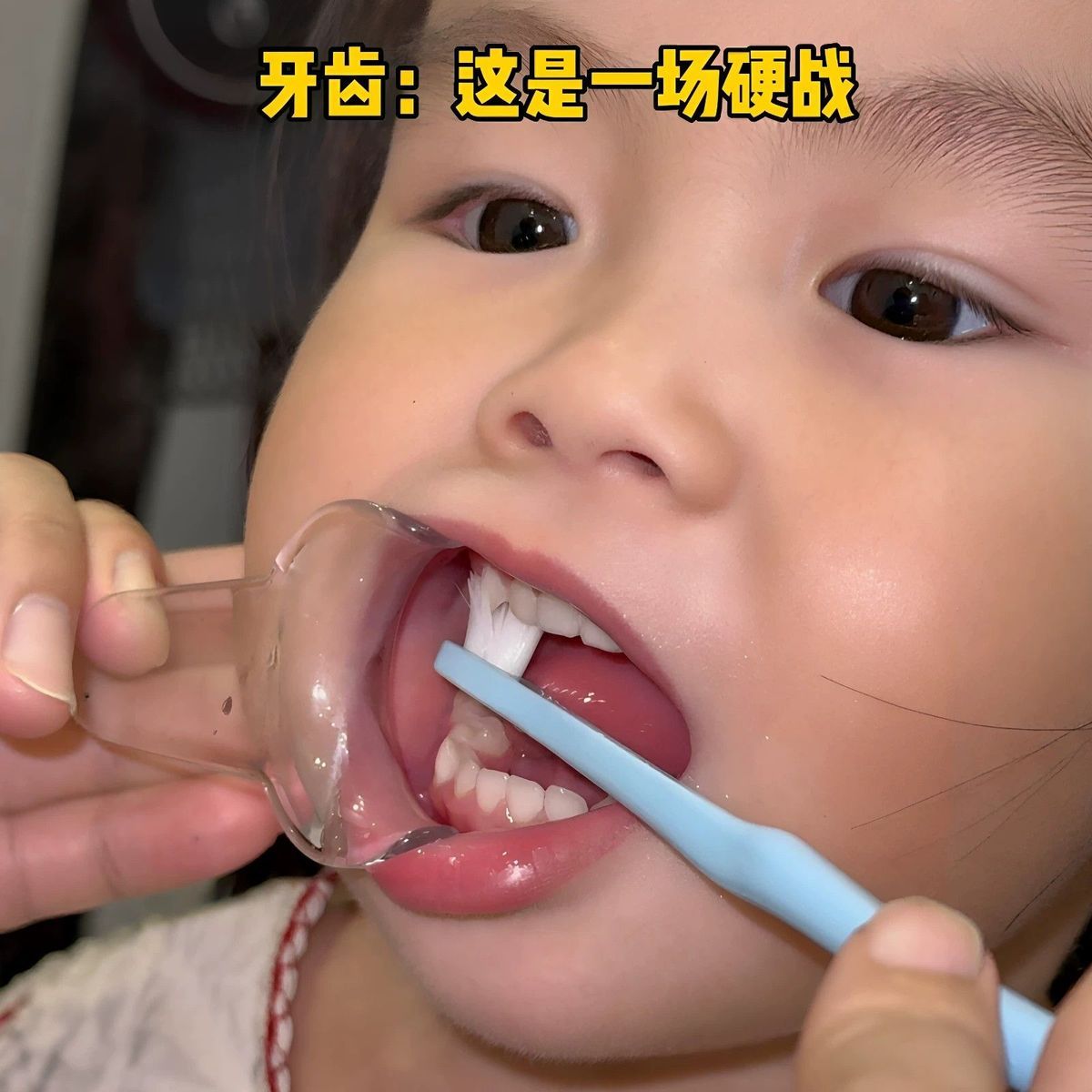 儿童刷牙辅助器开口器扩嘴工具