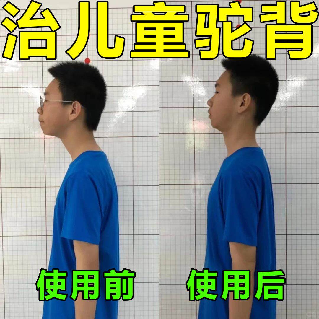 【永不再驼背】弯腰驼背矫正贴治疗高低肩预防脊柱侧弯学生矫正器