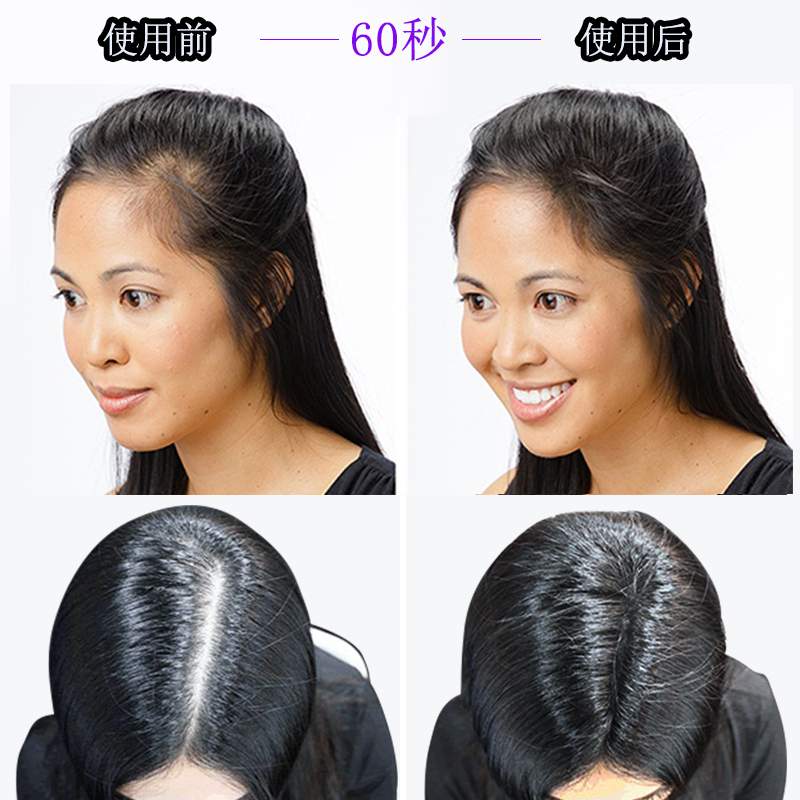 密丰密发增发纤维假发男补充包袋装粉快速美发变多变密发头发稀疏