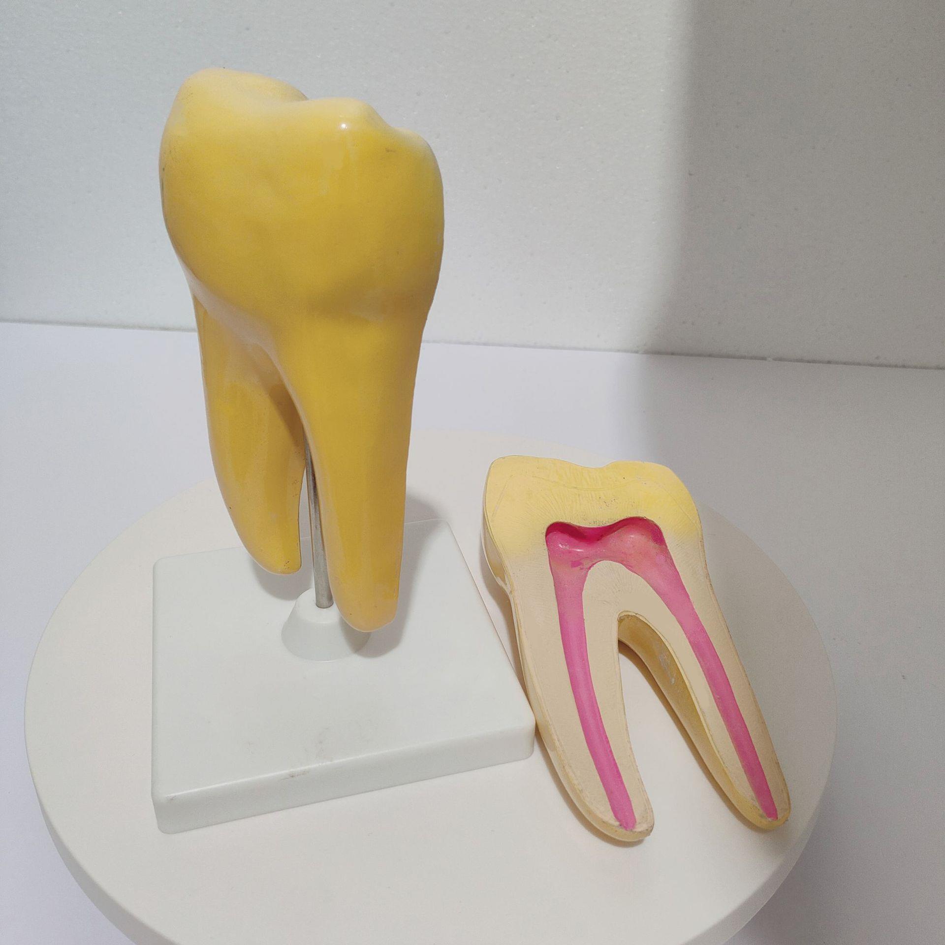 牙齿放大模型 大蛀牙解剖教学模型