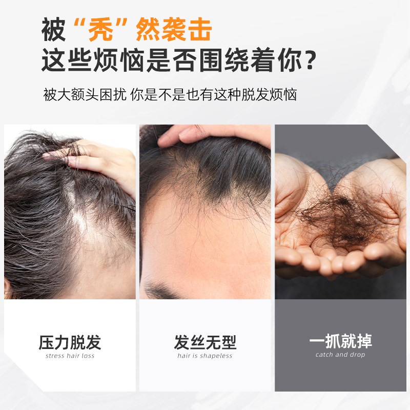 深v形发际线假发贴假刘海假发片m形发际线贴男一片式前额补发真发