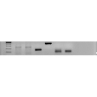 circRNA PCR引物设计.